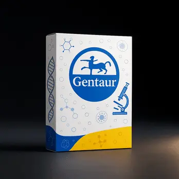 Toxocara canis IgG