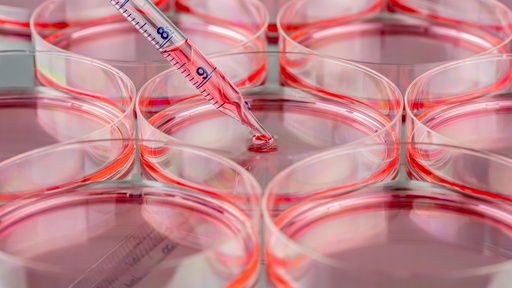 [SK-STEM-170] Human Umbilical Mesenchymal Stem Cells
